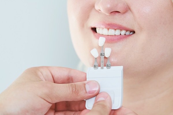 Can Dental Veneers Cover Imperfections On Teeth?